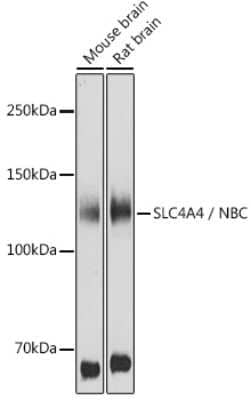 Western Blot: SLC4A4 Antibody [NBP2-94138] - Western blot analysis of extracts of various cell lines, using SLC4A4 antibody (NBP2-94138) at 1:1000 dilution. Secondary antibody: HRP Goat Anti-Rabbit IgG (H+L) at 1:10000 dilution. Lysates/proteins: 25ug per lane. Blocking buffer: 3% nonfat dry milk in TBST. Detection: ECL Basic Kit. Exposure time: 30s.